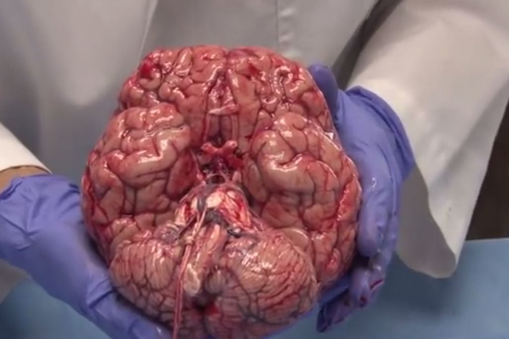 2013112010202611_20_2013_squishy-brain.jpg