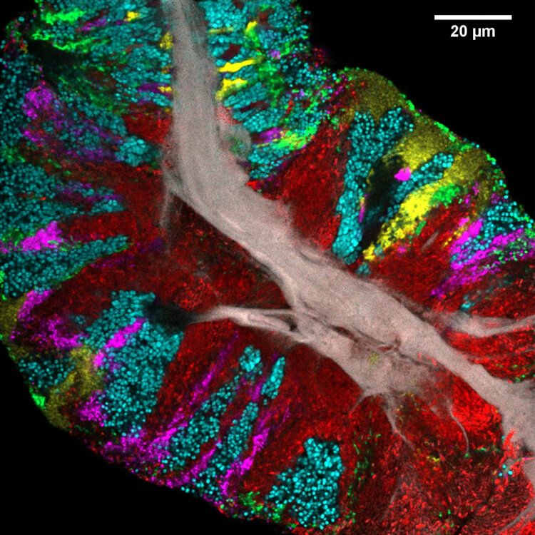 Tongue Bacteria