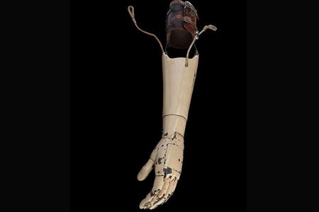 The Carnes arm had a complicated mechanism that controlled the movement of wrist and fingers. 