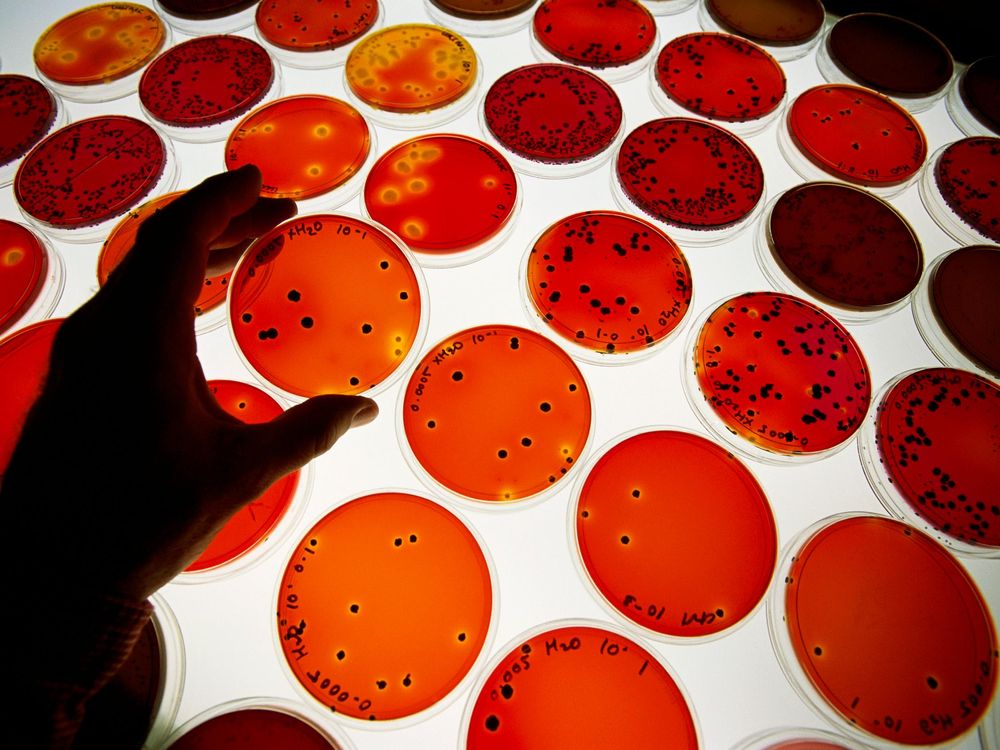 Petri Dishes