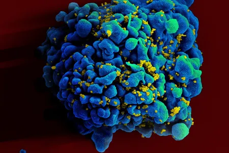 The trials will test the safety of the two experimental vaccines and how well it stimulates a broad range of antibodies against HIV in the body. Pictured: An HIV infected T-cell. 

