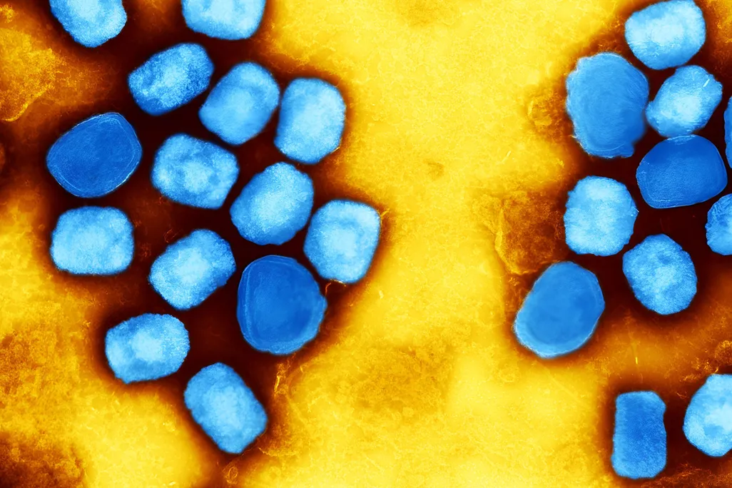 Blue mpox viral particles on a yellow background