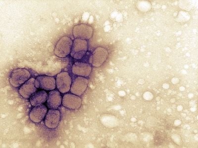 A cluster of variola viruses viewed under an electron microscope. Strains of the variola virus cause smallpox disease.
