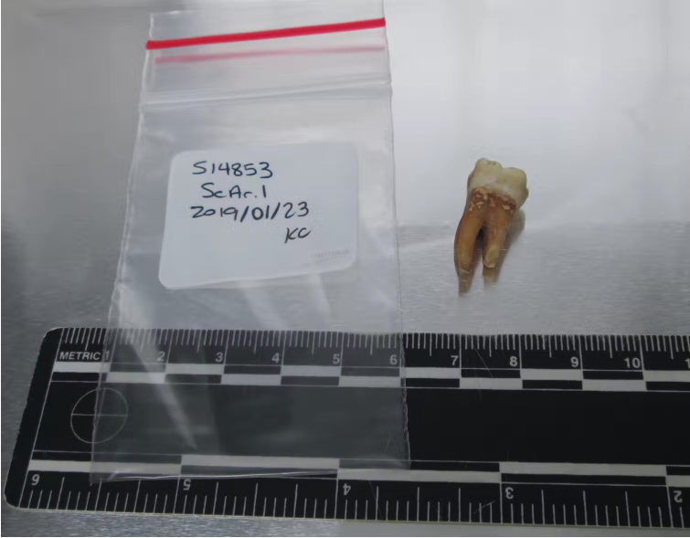 A tooth from a medieval Jew