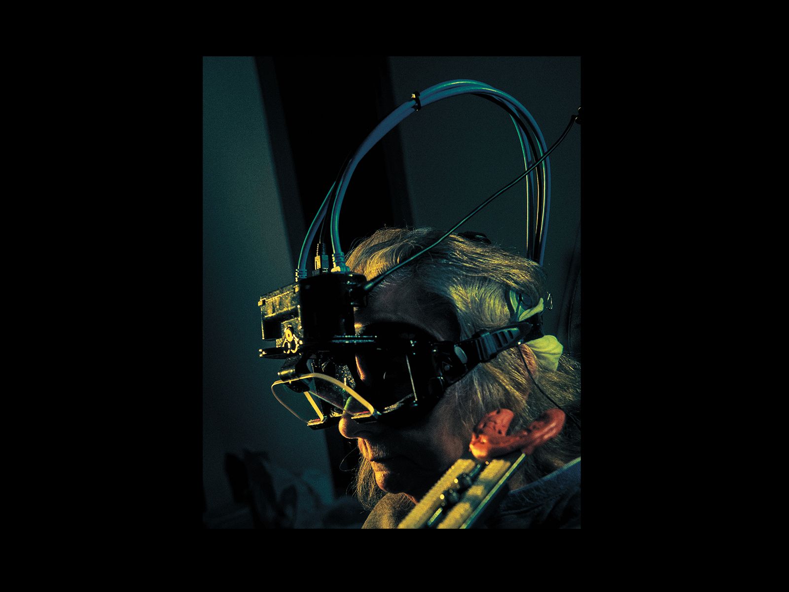 Can a Medical Device Restore Your Balance?