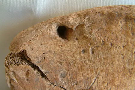 Researchers analyzed indentations in the skeleton&#39;s pelvis.