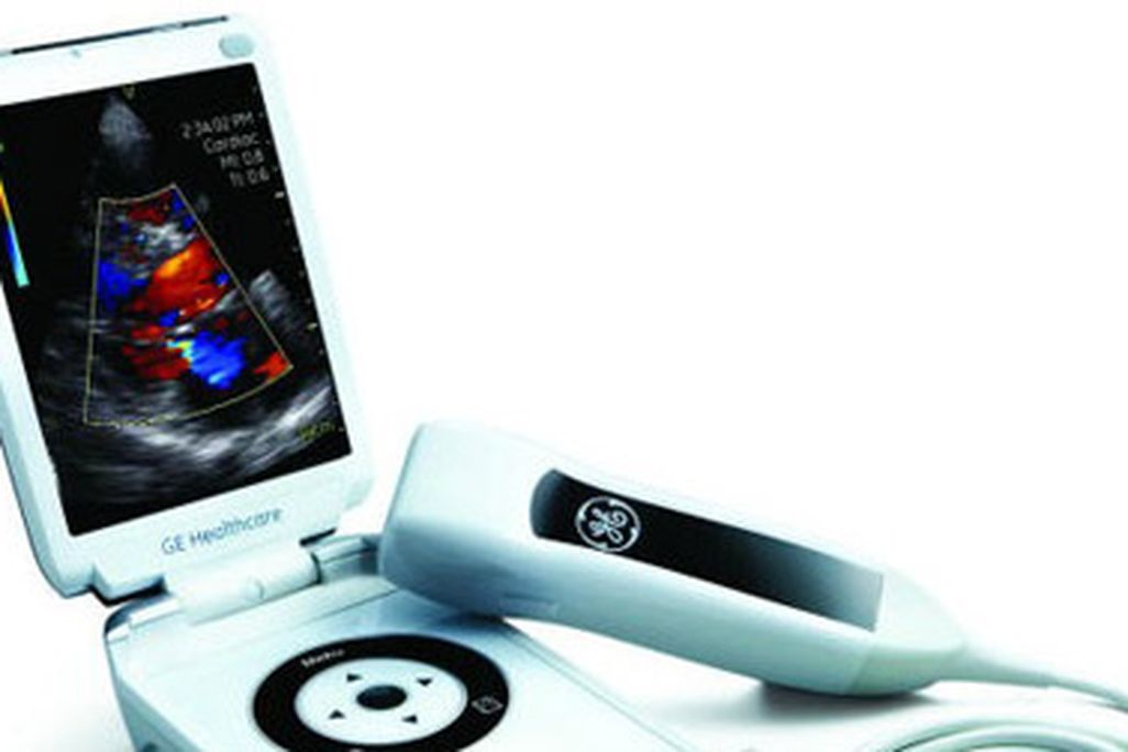 Reverse innovation in action: An ultrasound scanner shrinks to smartphone size.