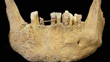 Why Did This Wealthy Scotsman Pay a Jeweler to Wrap His Teeth in Gold Wire Hundreds of Years Ago?