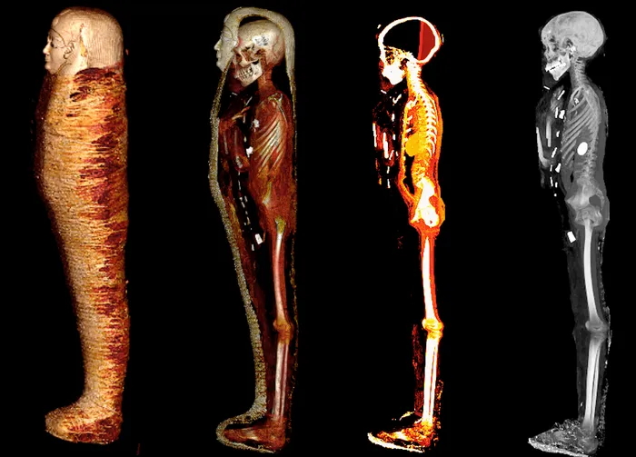 Four CT scans of a mummified body