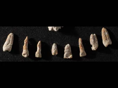 Teeth with dental inlays from a nonroyal elite Mayan tomb.