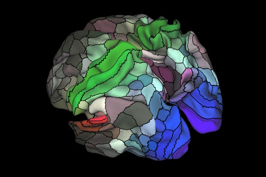 Brain Map 2