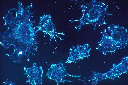 Cancer cells in culture from human connective tissue, illuminated by darkfield amplified contrast.
