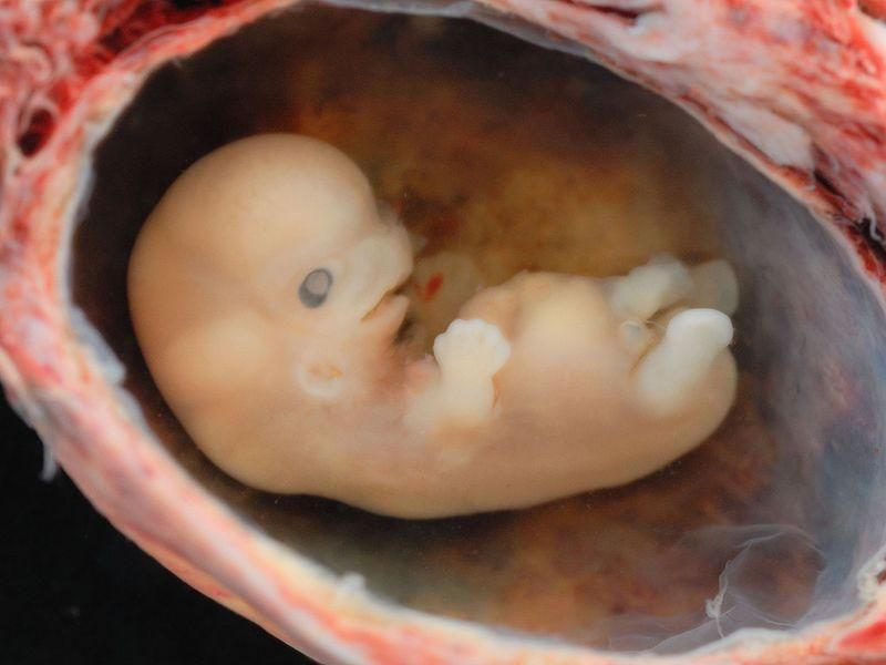 Human Embryo