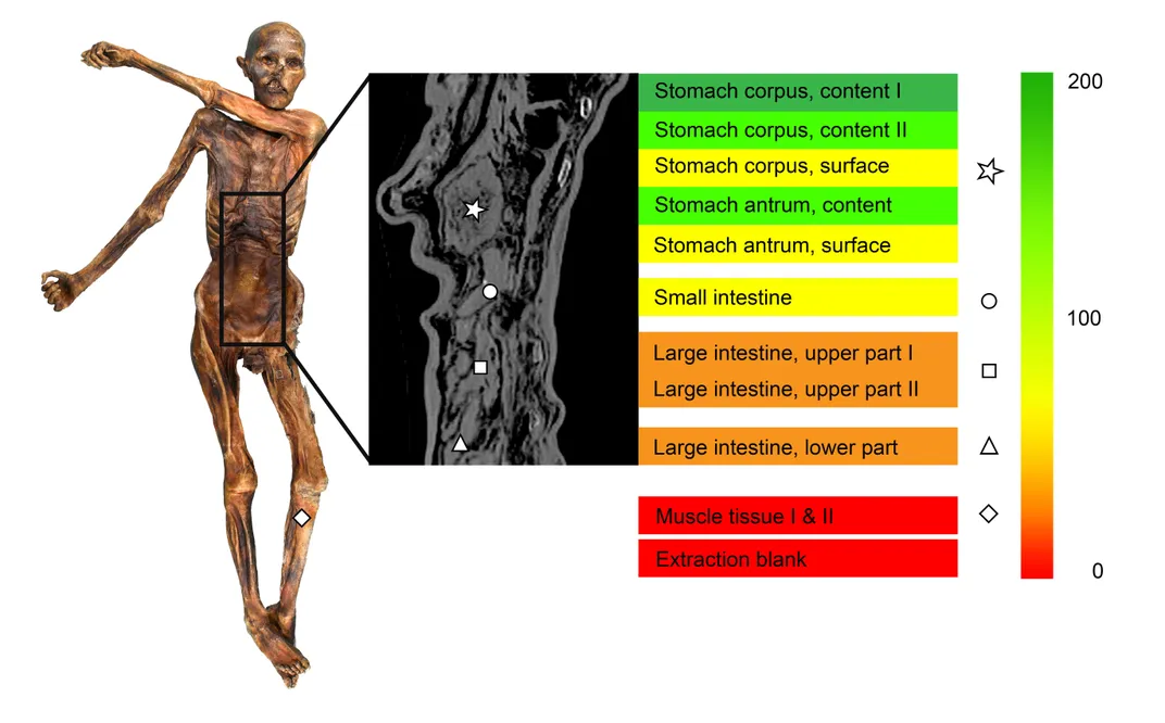 The Iceman's Stomach Bugs Offer Clues to Ancient Human Migration