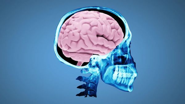 Preview thumbnail for TweenTribune: What Happens When You Get a Concussion?