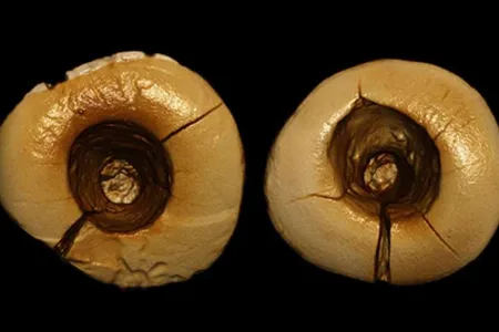Computer-assisted reconstruction of the cavities