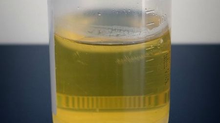 About the only use modern humans have for their urine is in health screenings. But preindustrial workers built entire industries based on the scientific properties of pee.