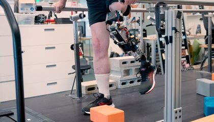 This New Bionic Knee Is Changing the Game for Lower Leg Amputees