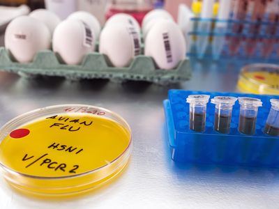The U.S. has reported 66 human cases of H5N1 bird flu since March 2024, but a recent death of a Louisiana resident marks the country&rsquo;s first fatality from the virus.