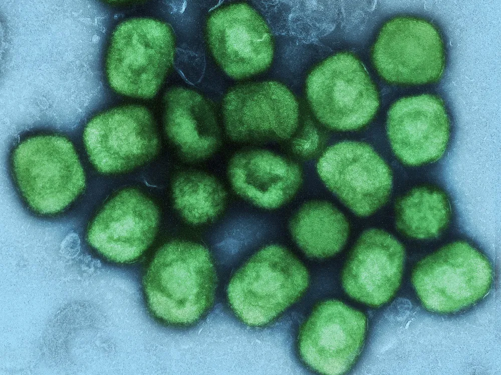 Colorized transmission electron micrograph of monkeypox virus particles (green) cultivated and purified from cell culture