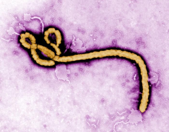 Ebola virion TEM