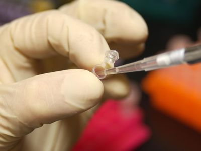 A researcher uses a pipette to remove DNA from a micro test tube. 