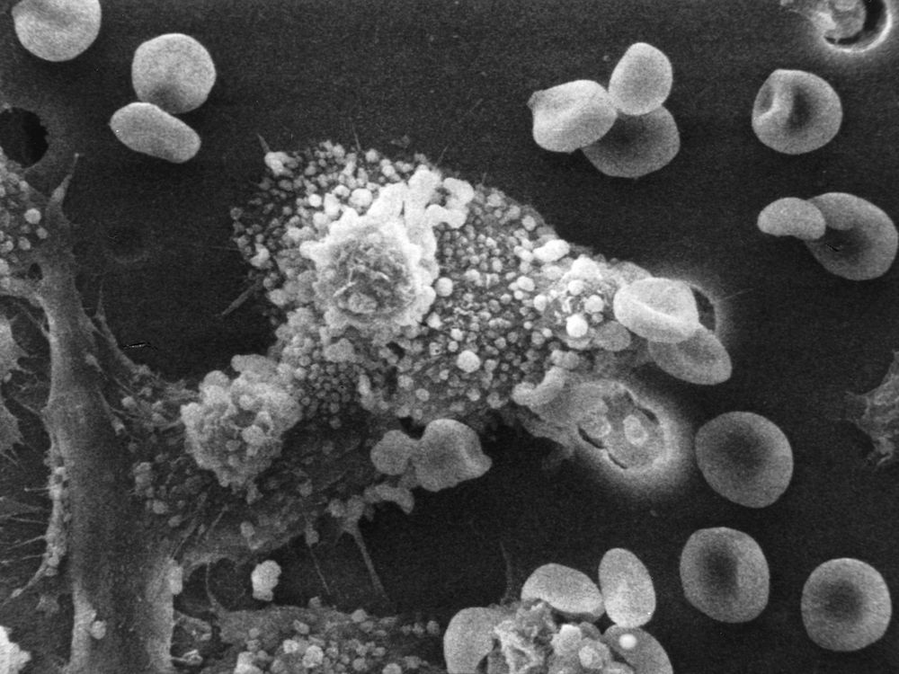 The cell starts rounding up and loses its spikes