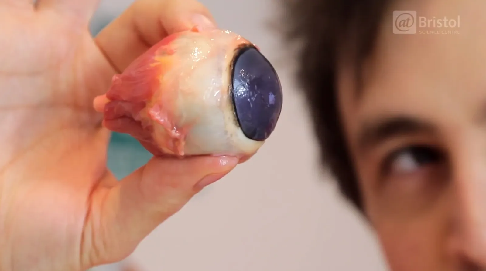 If You Like Gore, You'll Like Watching This Eyeball Get Dissected, Smart  News