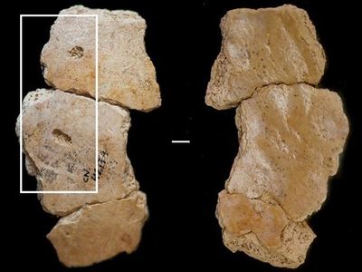 Unearthed at the Cova Negra site in Spain, skull fragments from a Neanderthal child have telltale punctures in the right parietal region. 