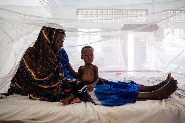 Severely malnourished Haawo is strengthening in a stabilization center thumbnail