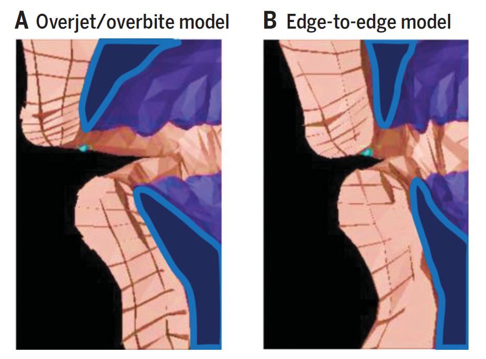 Biomechanical Model