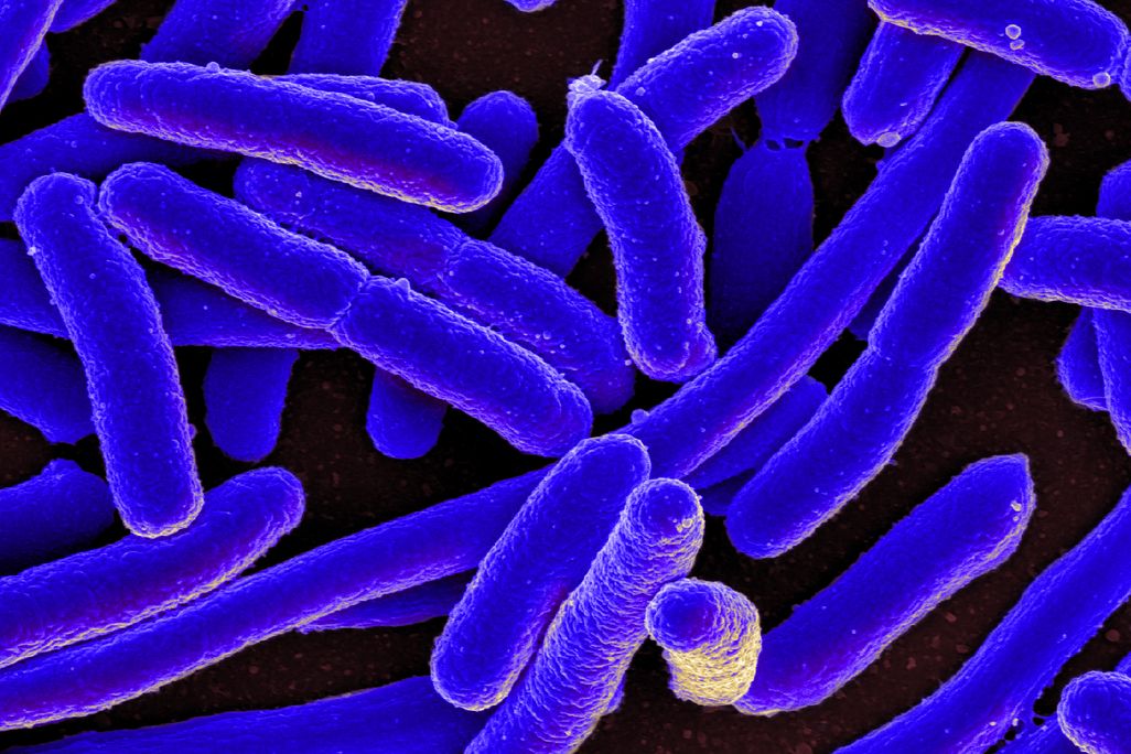 An image of E. coli