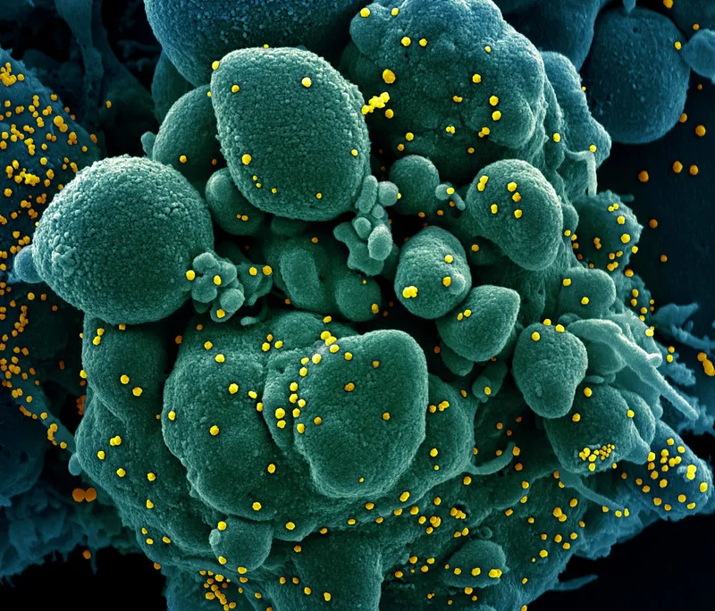 SARS-COV-2 virus particles on a cell