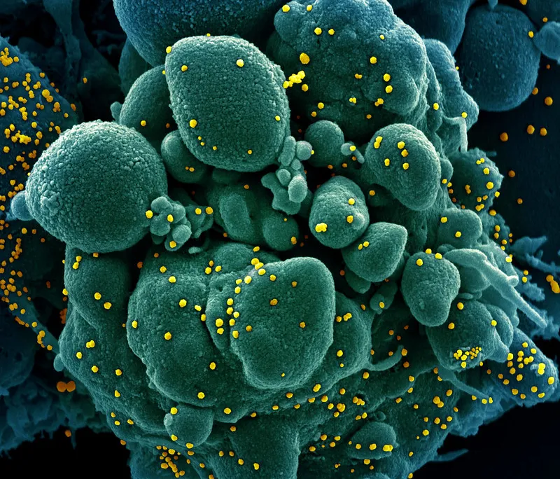 SARS-COV-2 virus particles on a cell