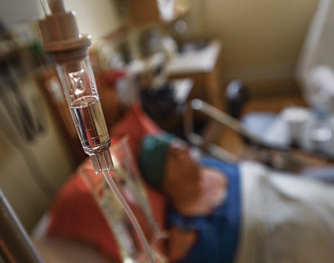 Cancer Chemotherapy Patient Examining Iv Chest Port High-Res Stock Photo -  Getty Images