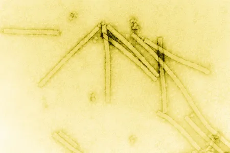 The tobacco mosaic virus seen under 160,000× magnification