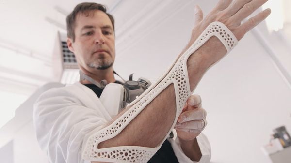 Preview thumbnail for This Bionic Suit May Be the Future of Prosthetics