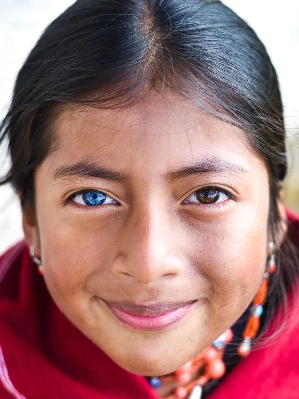 Eyeversity thumbnail