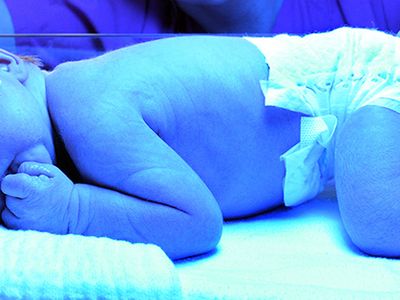 Jaundice is usually treated with short-wave blue light.
