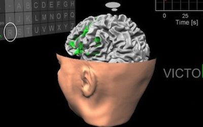The system detects patients’ thoughts via an fMRI machine and translates these into specific letters.