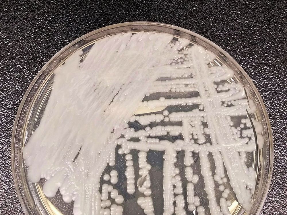 An upclose photo of a petri dish innoculated with <i>C. auris<i/>