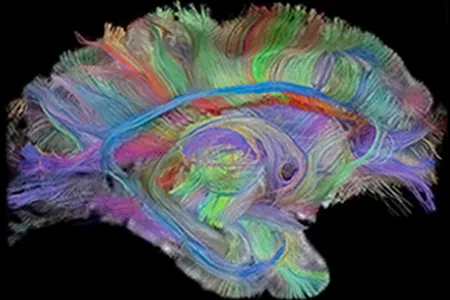 Can a brain be Republican or Democrat?