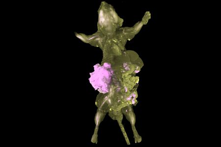 Bioluminescent cancer cells appear in a three-dimensional scan of a mouse with cleared tissue. 