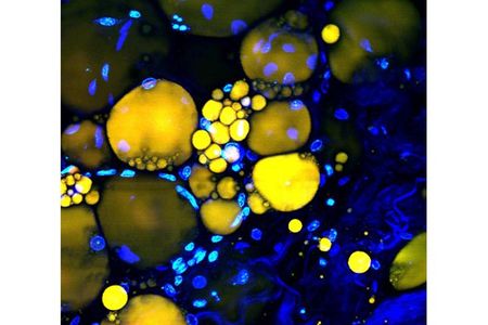 The small, bright yellow dots are lipid cells within subcutaneous fat tissue, which can be used as natural lasers.