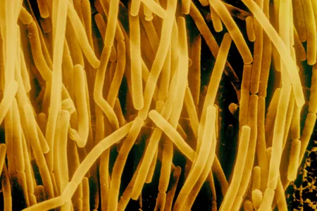 The soil microbe Bacillus subtilis is ubiquitous, but one rare strain yielded scientific pay dirt. 