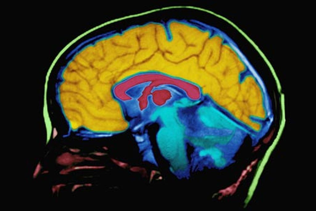 Brain myths