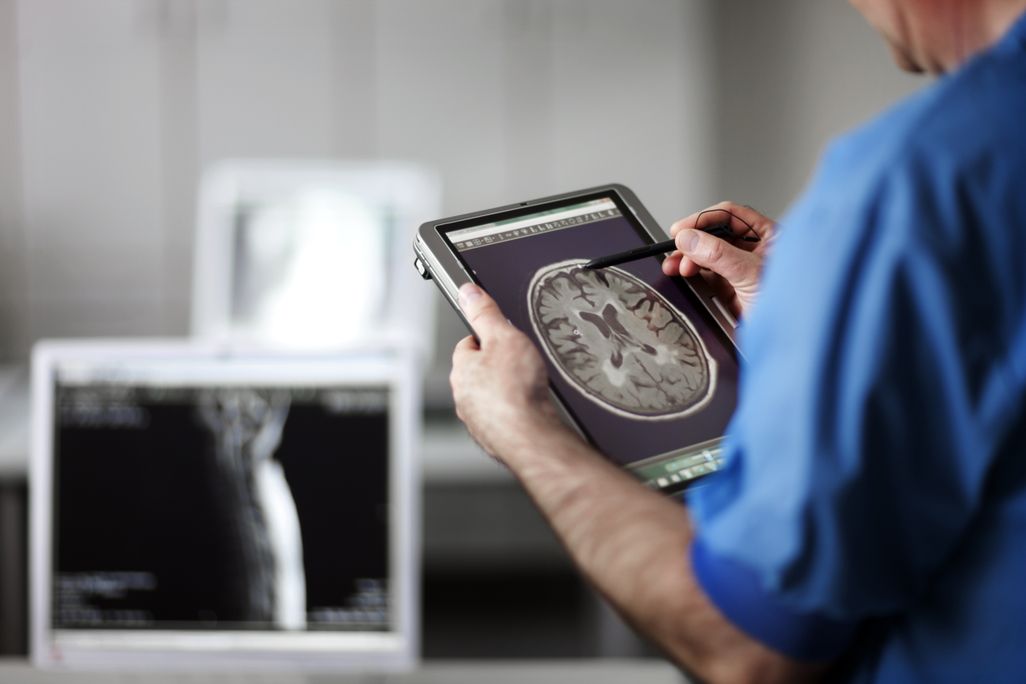 image of a male doctor holding a tablet with an mri scan on it