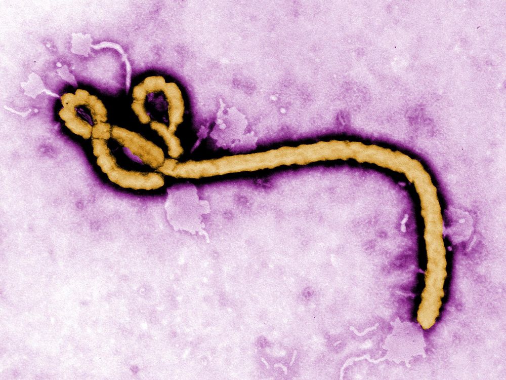 Ebola Virus