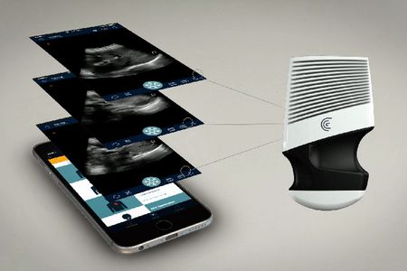 Clarius is the first ultrasound developer to go wireless, pairing its handheld device with a smartphone.