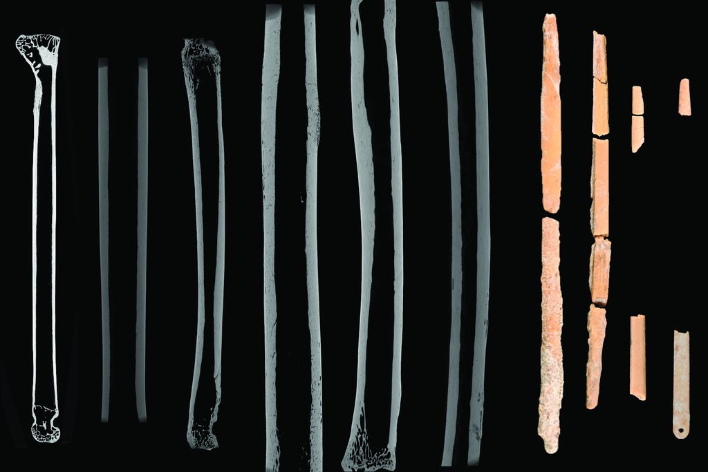 Bone needle scans